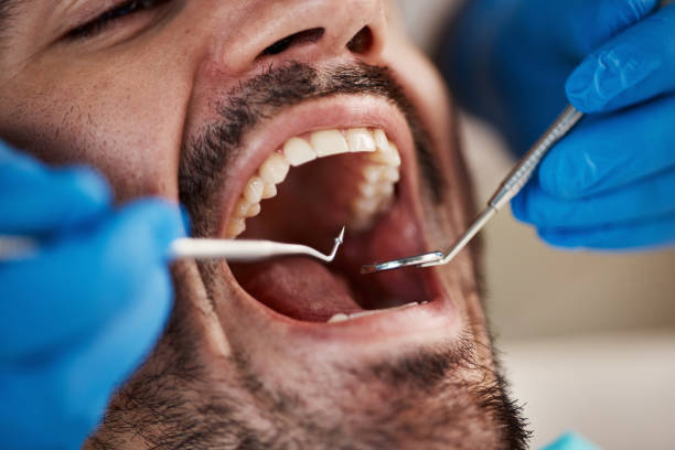 TMJ/TMD Treatment in Lakes Of The Four Seasons, IN